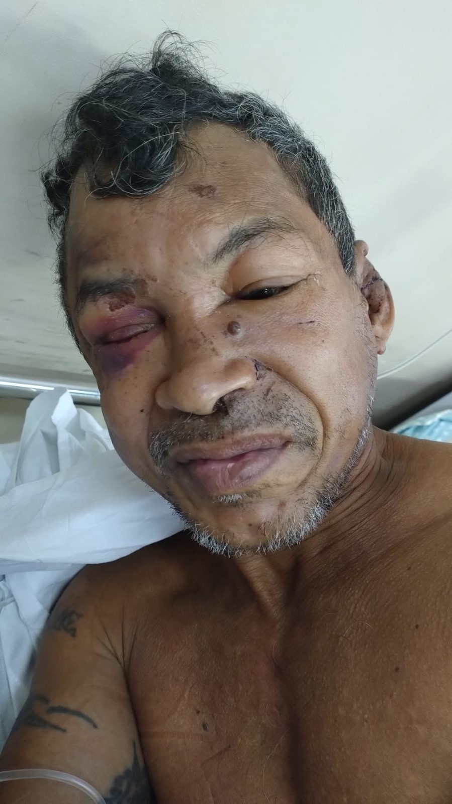 Hospital João Lúcio procura família de paciente internado por espancamento