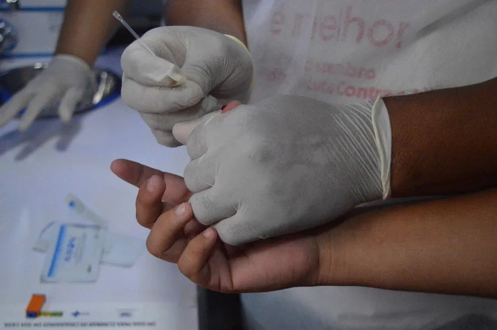Lei estimula realização de teste rápido de HIV/AIDS no Amazonas
