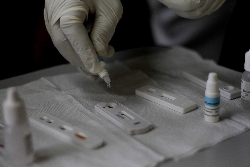 Medicamento de prevenção ao HIV é disponibilizado em Manaus