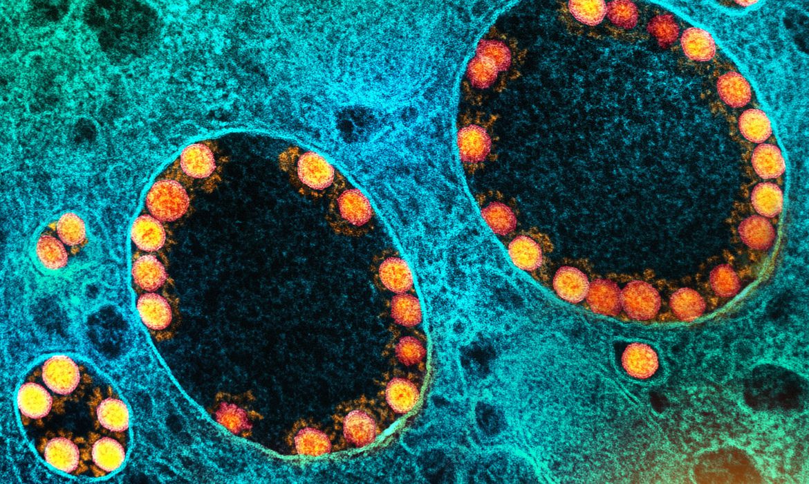 Covid-19: Brasil tem 62 mortes confirmadas nas últimas 24 horas