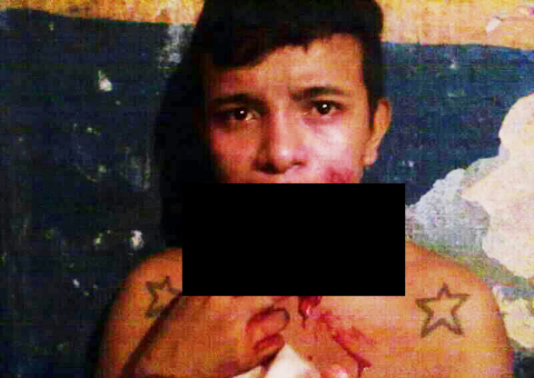 Foto de detento com a boca rasgada circula na internet. Sejus e SSP explicam como ocorreu o motim