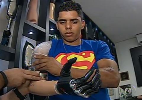 Ciclista recebe braço biônico com tatuagem