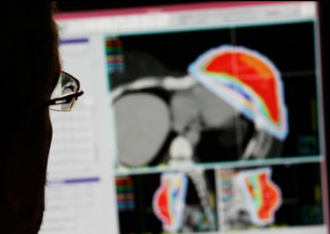 Bisturi inteligente pode identificar tecidos cancerosos