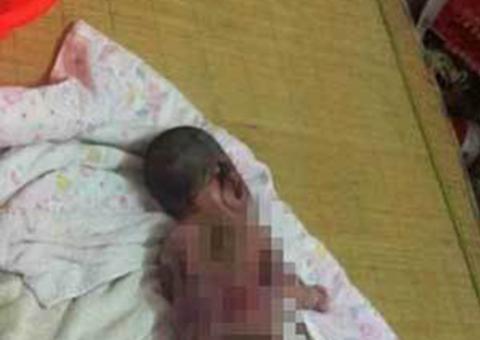 Bebê morre queimado em incubadora defeituosa