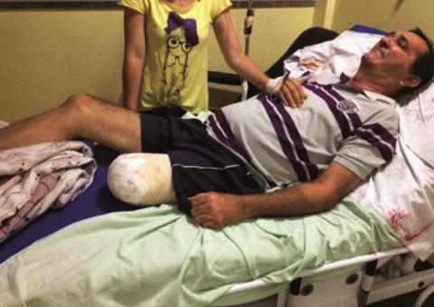 Preso na Operação Gaia tem perna amputada por falta de atendimento médico