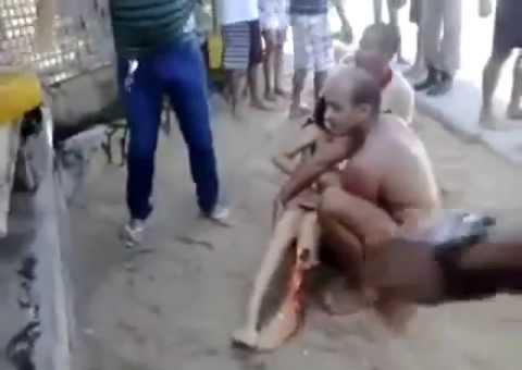 Vídeo de ataque tubarão em Recife repercute mundialmente