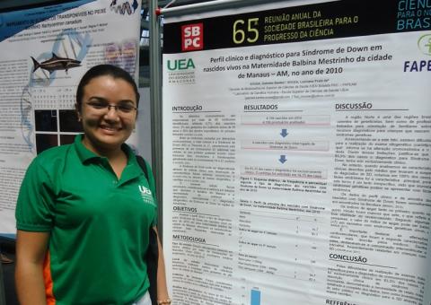 Diagnóstico de síndrome de Down é basicamente clínico