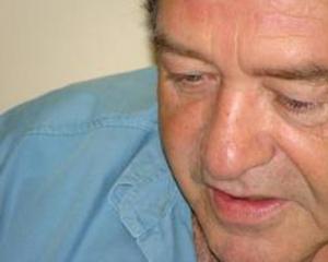 BRAGA TENTA APAGAR INCÊNDIO QUE PROVOCOU NO PT