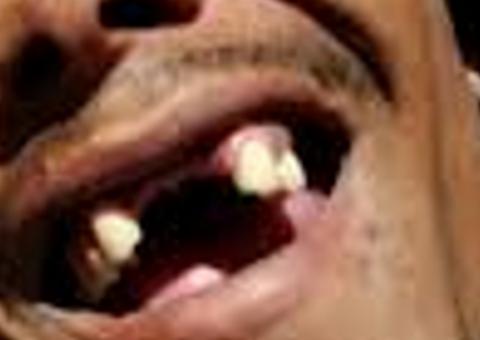 Governo Federal libera R$ 984 mil para desdentados de 10 municípios do Amazonas