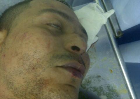 Policiais  civis e foragido do Compaj  feridos durante troca de tiros em Manaus