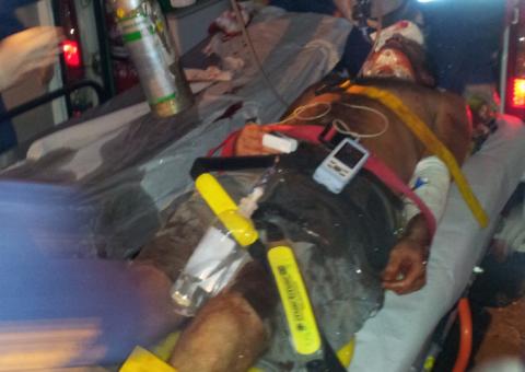 Motoqueiro dorme pilotando moto, bate em poste e fica gravemente ferido 