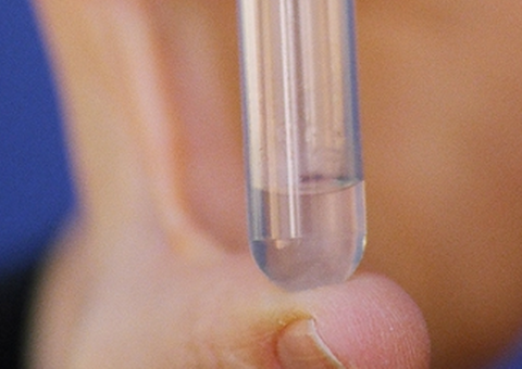 Anticoncepcional masculino é testado nos Estados Unidos