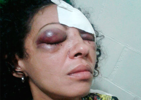 Agressor espanca vítima, tenta estupro, rouba celular, mas é solto