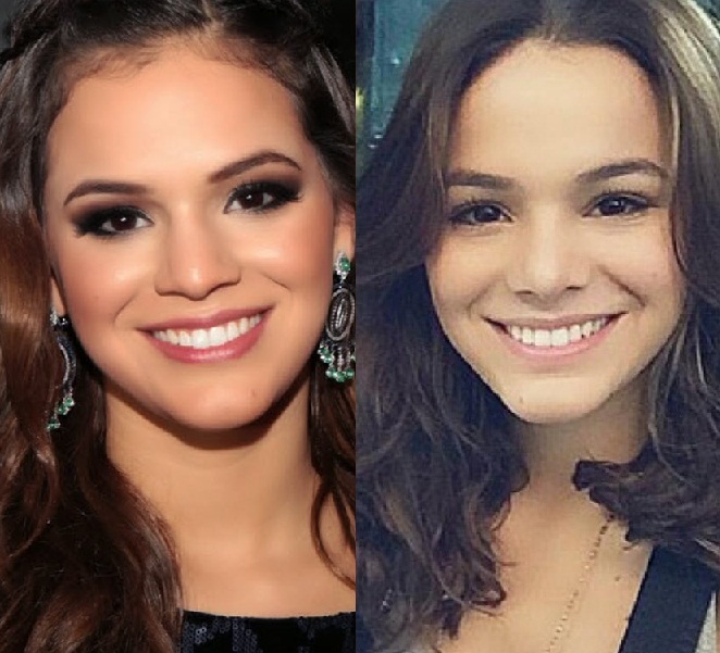  15 famosos que mudaram mas não assumem ter feito cirurgia plástica