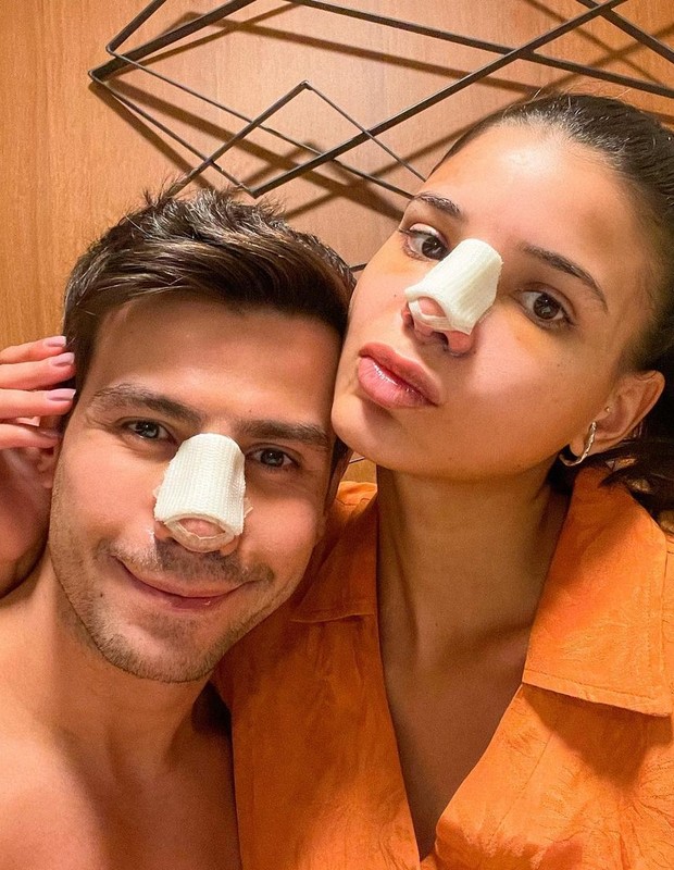 Sertanejo Mariano e Jakelyne Oliveira fazem rinoplastia juntos e postam fotos após cirurgia