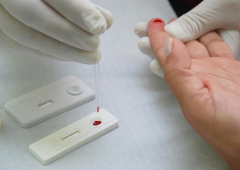 Cientista desenvolvem pen drive que detecta HIV em 30 minutos