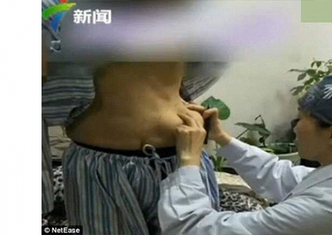 Após ‘gel milagroso’ falhar, seios de mulher ‘descem’ para a barriga