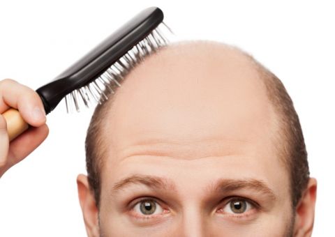 Se eu usar boné por muito tempo, vou ficar careca? 