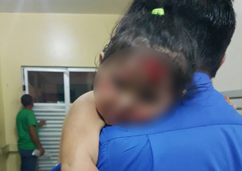 Bandidos agridem mãe e filha durante assalto no AM