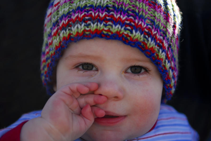  Fimose em bebês é comum mas é preciso cuidar
