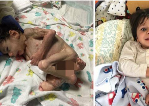 Mulher adota criança à beira da morte após ver foto no Facebook