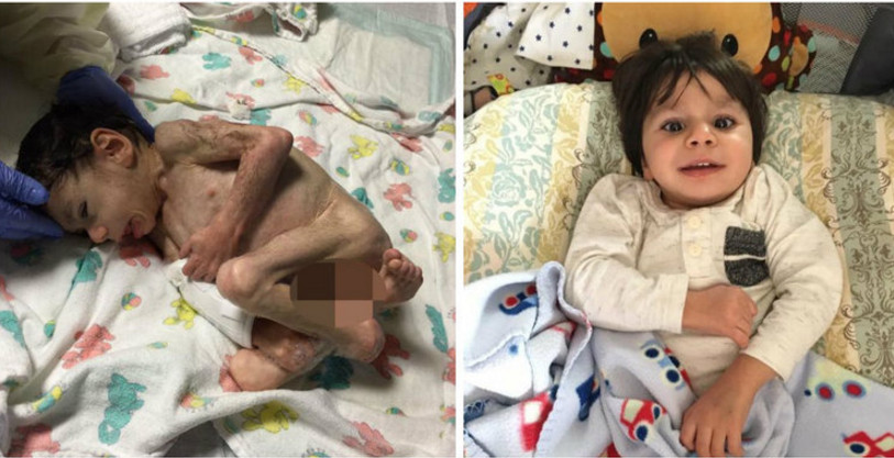 Mulher adota criança à beira da morte após ver foto no Facebook