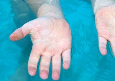 Por que a pele enruga na água?