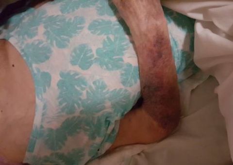 Idosa é agredida por cuidador dentro de asilo 