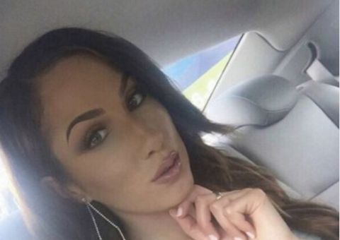 Mulher se submete a várias cirurgias plásticas para parecer com modelo famosa