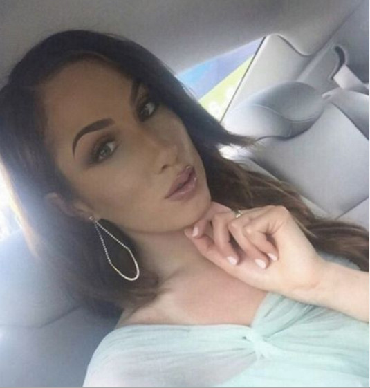 Mulher se submete a várias cirurgias plásticas para parecer com modelo famosa