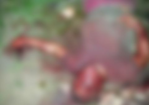  Em Manaus, corpo de homem é encontrado com terçado cravado no rosto 