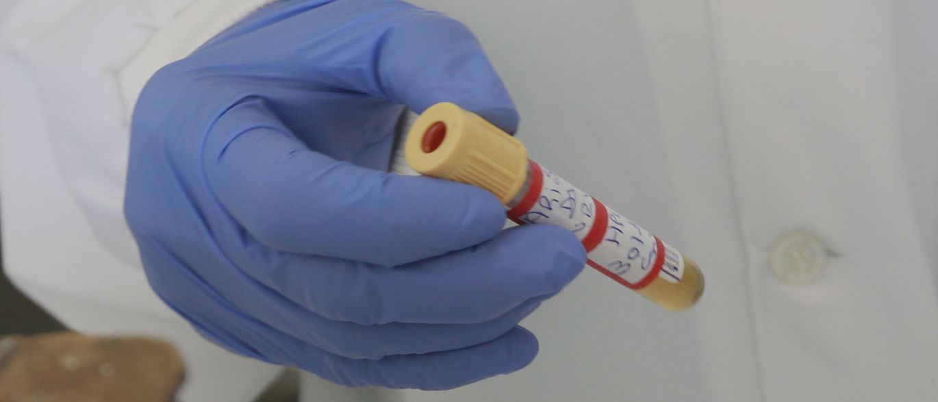 Vírus misterioso deixa a urina preta em Salvador