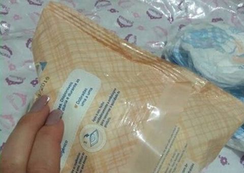 Bebê tem córnea cortada por pacote de lenço umedecidos 