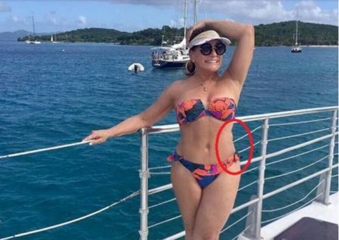 Susana Vieira posa de biquíni e algo chama atenção