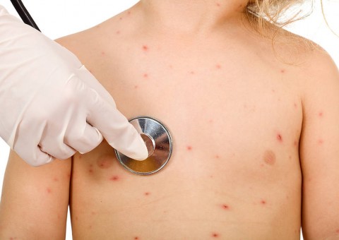 Chá de ‘Paciência’ ajuda na cura de doenças na pele 