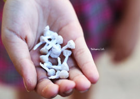 Menino vai dormir com bombinhas e fósforos na cueca e o pior acontece