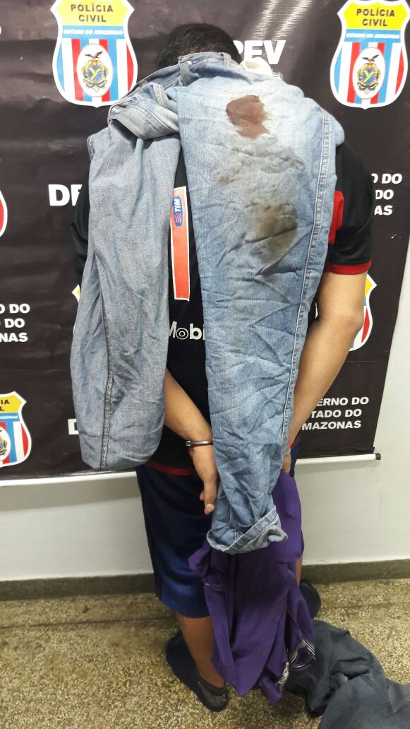 Homem rouba moto e deixa trabalhador gravemente ferido