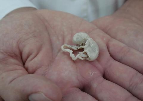 UEA contará com primeiro Laboratório de Plastinação da Região Norte