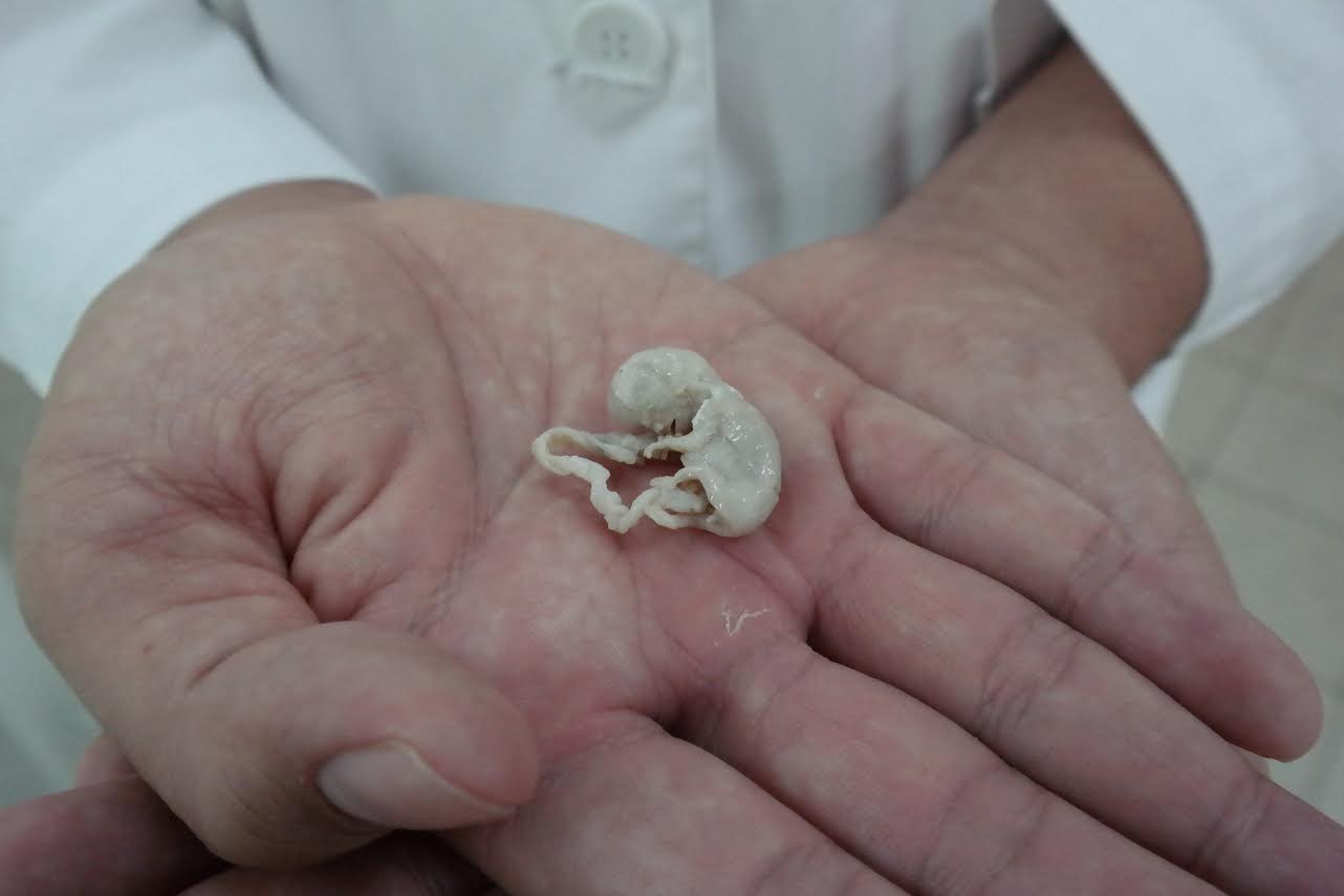 Primeiro Laboratório de Plastinação da Região Norte será implantando na UEA 