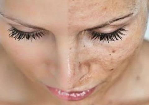 5 coisas que te envelhecem mais rápido e você pode mudar hoje