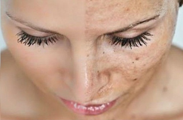 5 coisas que te envelhecem mais rápido e você pode mudar hoje