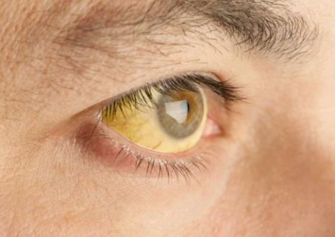 Minas decreta emergência com 38 mortes suspeitas de febre amarela