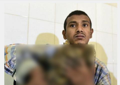 'Homem-árvore' faz 16 cirurgias após conviver com doença rara