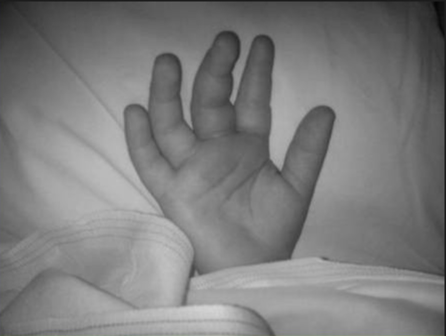 Criança de 2 anos é internada após ser intoxicada por drogas em Manaus