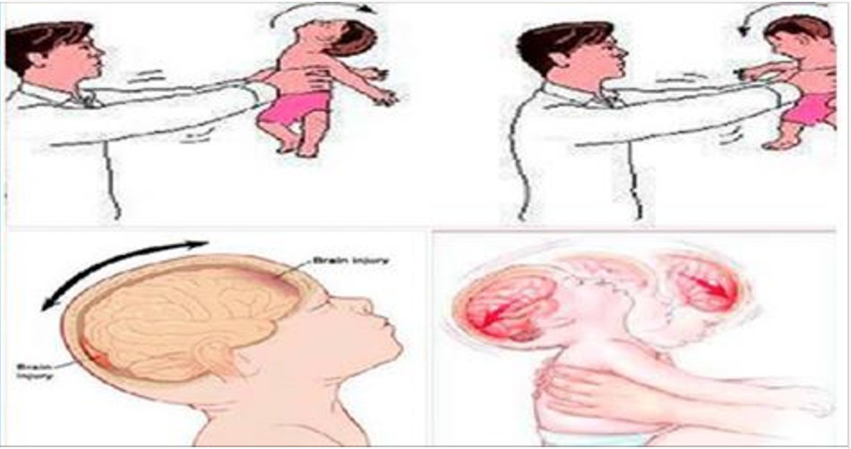 Alerta: Jogar filho para cima pode ser mortal