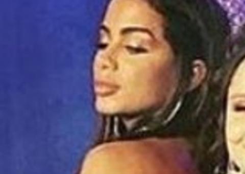 Anitta discute com fã na web após ter preenchimento labial criticado
