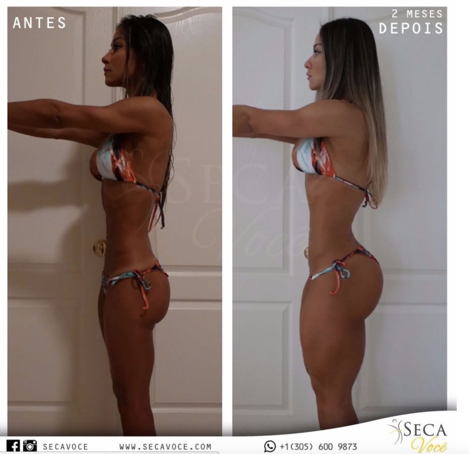 Após cirurgia e 60 dias sem andar, Mayra Cardi mostra corpo inacreditável em ensaio sensual 