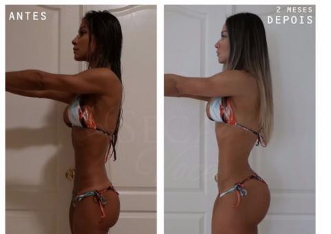 Após cirurgia e 60 dias sem andar, Mayra Cardi mostra corpo inacreditável em ensaio sensual 