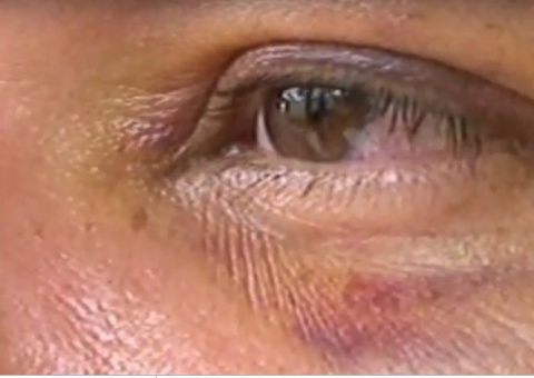 Mulher reage após invasão de casa e expulsa assaltante no tapa