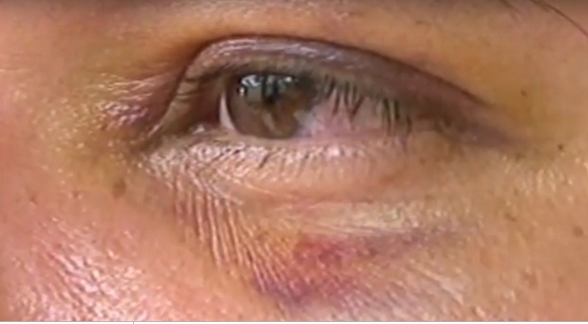 Mulher reage após invasão de casa e expulsa assaltante no tapa